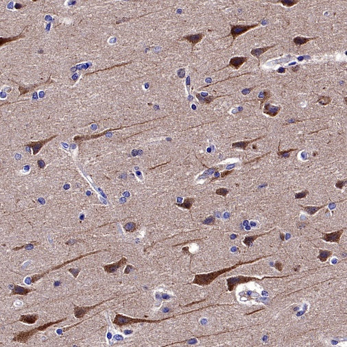 Atg13 Recombinant Rabbit mAb (S-2534-22)