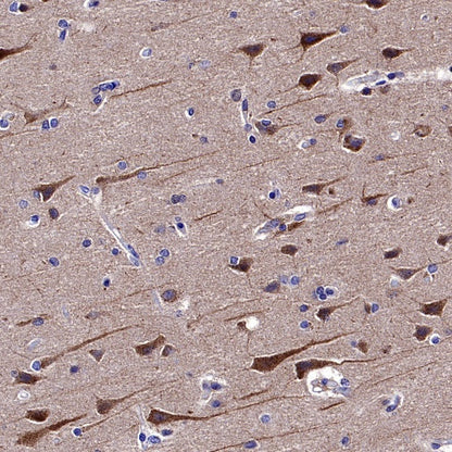 Atg13 Recombinant Rabbit mAb (S-2534-22)