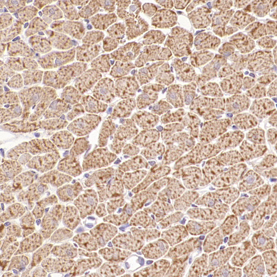 VDAC3 Rabbit Polyclonal Antibody