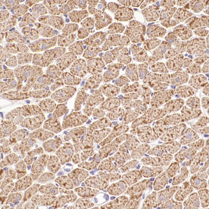 VDAC3 Rabbit Polyclonal Antibody