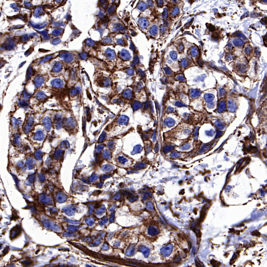 β-Actin Recombinant Rabbit mAb (S-5701)