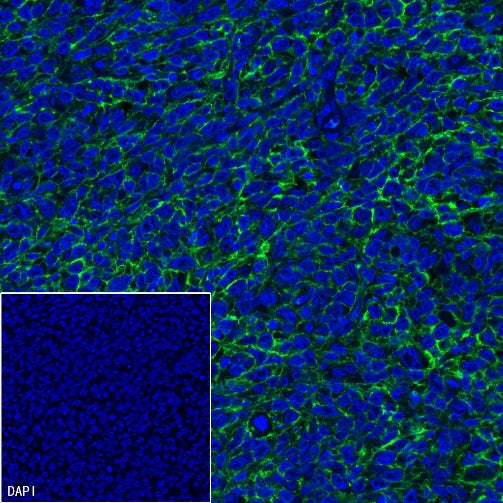CD20 Recombinant Rabbit mAb (Alexa Fluor® 488 Conjugate) (S-R133)