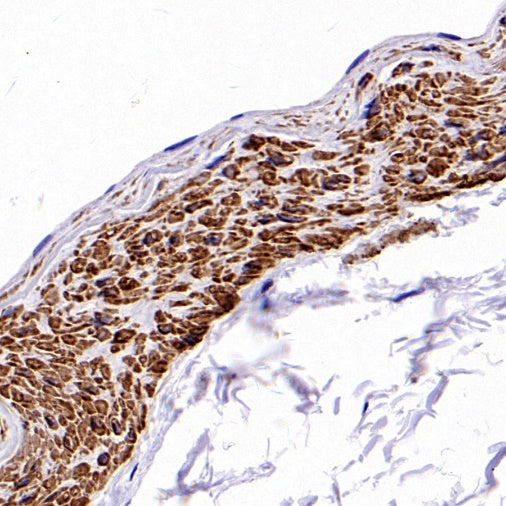alpha smooth muscle Actin (acetyl E3) + ACTG2 (acetyl E3) Recombiant Rabbit mAb (S-3355)