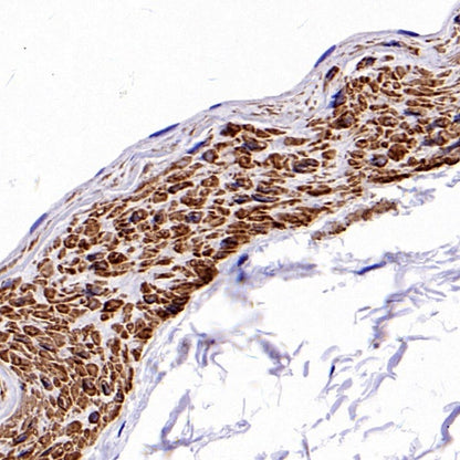 alpha smooth muscle Actin (acetyl E3) + ACTG2 (acetyl E3) Recombiant Rabbit mAb (S-3355)