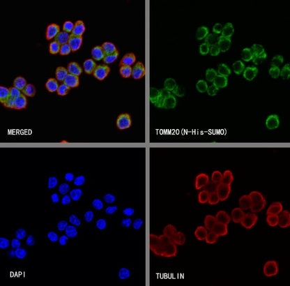 TOM20 Recombinant Rabbit mAb (SDT-2553-11)