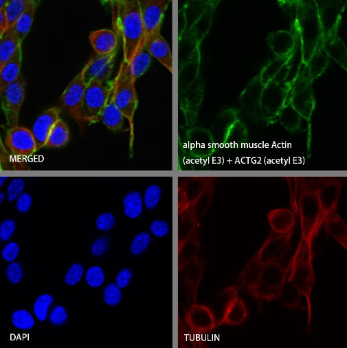 alpha smooth muscle Actin (acetyl E3) + ACTG2 (acetyl E3) Recombiant Rabbit mAb (S-3355)
