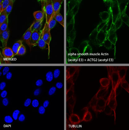 alpha smooth muscle Actin (acetyl E3) + ACTG2 (acetyl E3) Recombiant Rabbit mAb (S-3355)