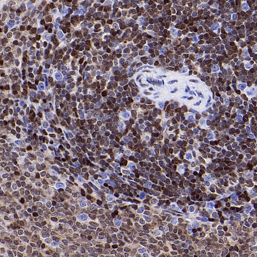 p27 Kip1 Recombinant Rabbit mAb (SDT-361-324)