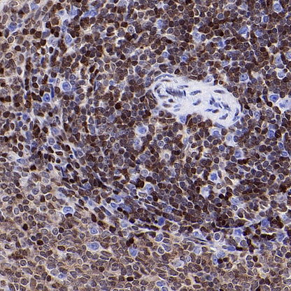 p27 Kip1 Recombinant Rabbit mAb (SDT-361-324)