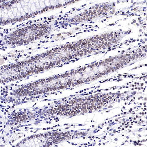 RanBP2 Recombinant Rabbit mAb (S-2593-310)