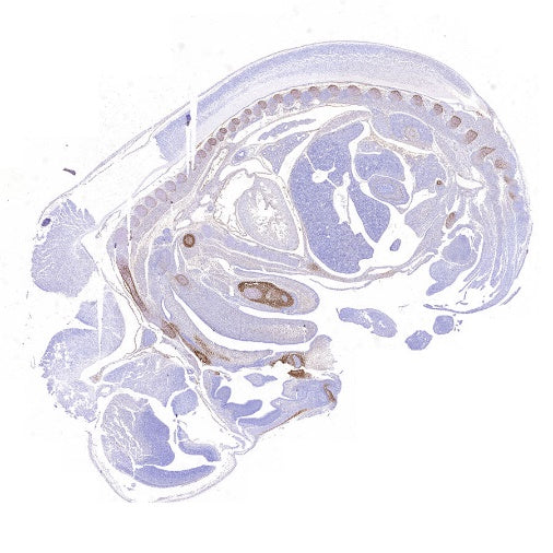 Sp7/Osterix Recombinant Rabbit mAb (SDT-3238-16)