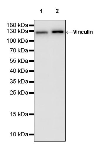 Vinculin Recombinant Rabbit mAb (S-1635-3)