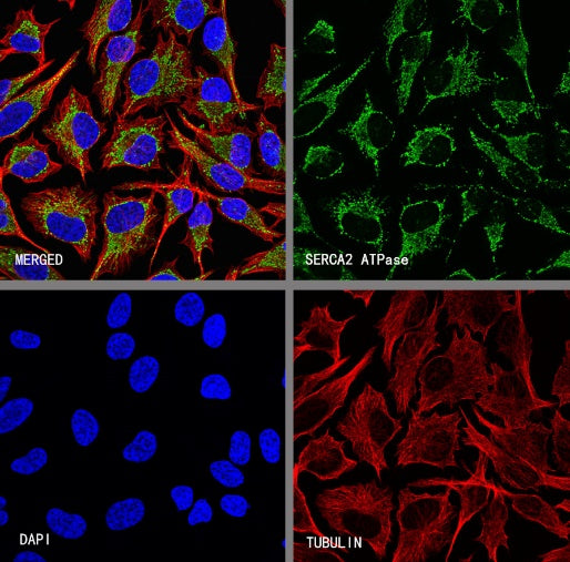 SERCA2 ATPase Recombinant Rabbit mAb (S-5956)