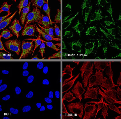 SERCA2 ATPase Recombinant Rabbit mAb (S-5956)