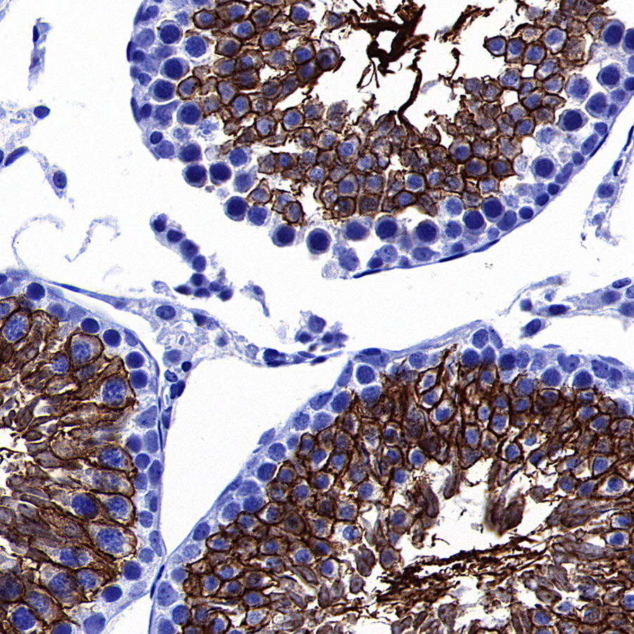 GLUT3 + GLUT14 Recombinant Rabbit mAb (S-5945)