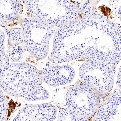 QPRT Recombinant Rabbit mAb (S-1228-31)