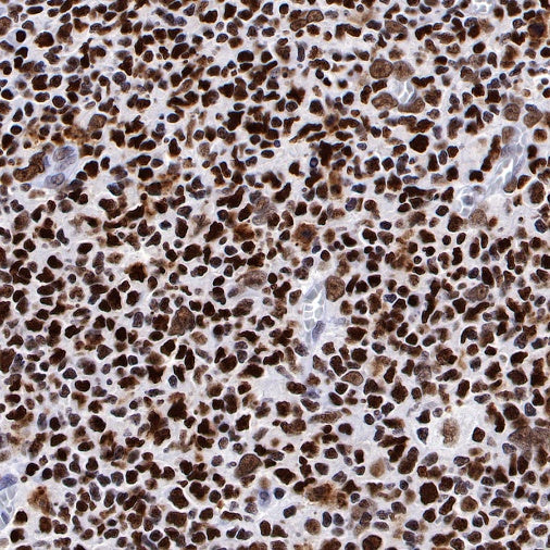 PARP1 Recombinant Rabbit mAb (S-R299)
