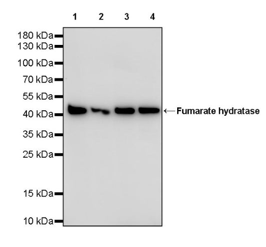 Fumarate hydratase Recombinant Rabbit mAb, PBS Only (SDT-2394-36)