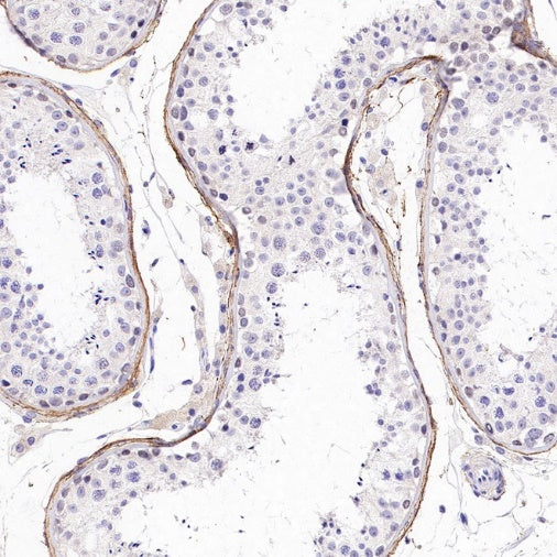 Versican Recombinant Rabbit mAb (S-3770-43)