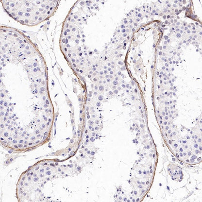 Versican Recombinant Rabbit mAb (S-3770-43)