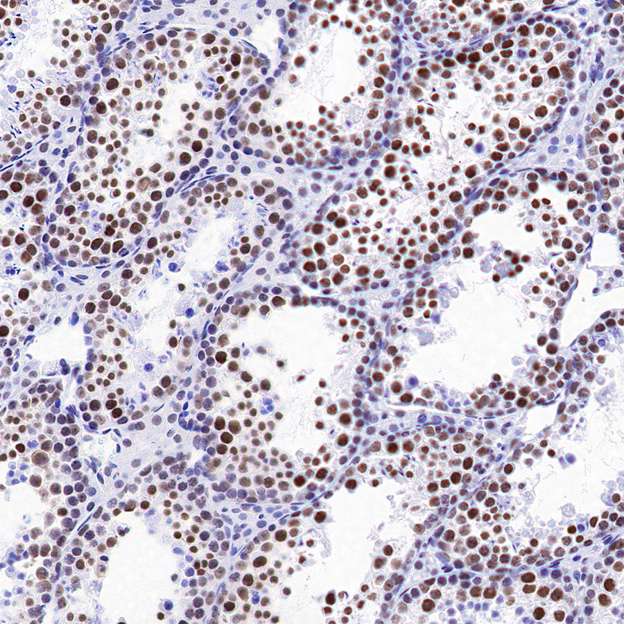 SMARCA3 Recombinant Rabbit mAb (S-3575-154)