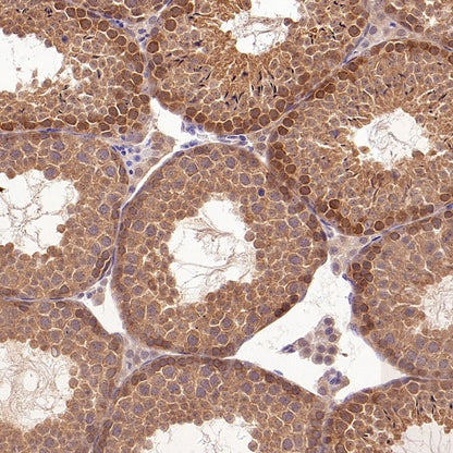 UBE2F Recombinant Rabbit mAb (S-2672-26)