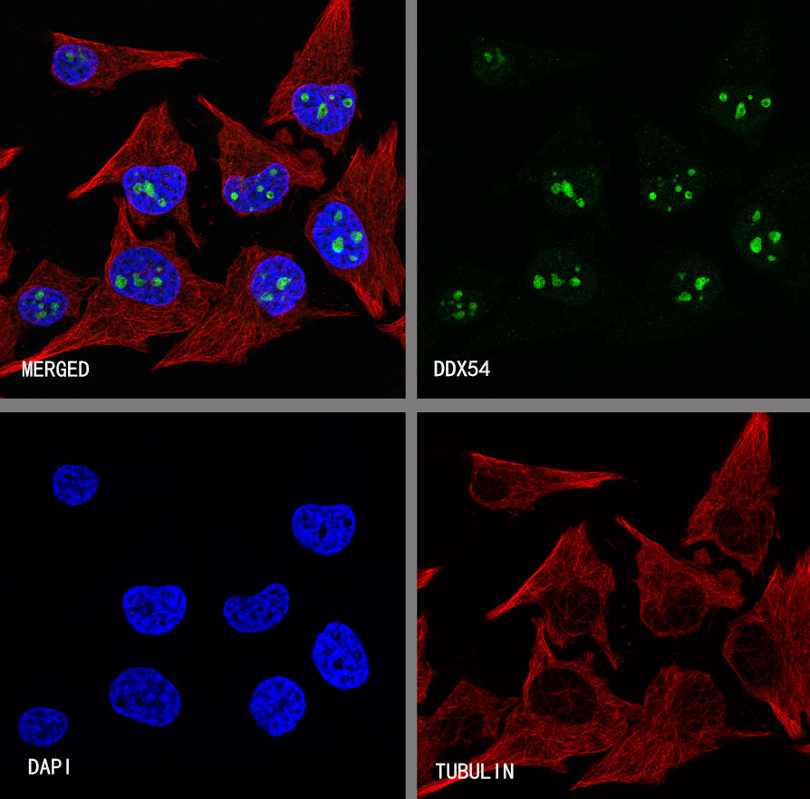 DDX54 Recombinant Rabbit mAb (S-4550-54)