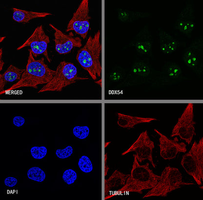 DDX54 Recombinant Rabbit mAb (S-4550-54)
