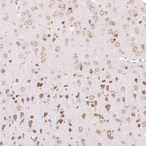 G3BP1 Rabbit Polyclonal Antibody