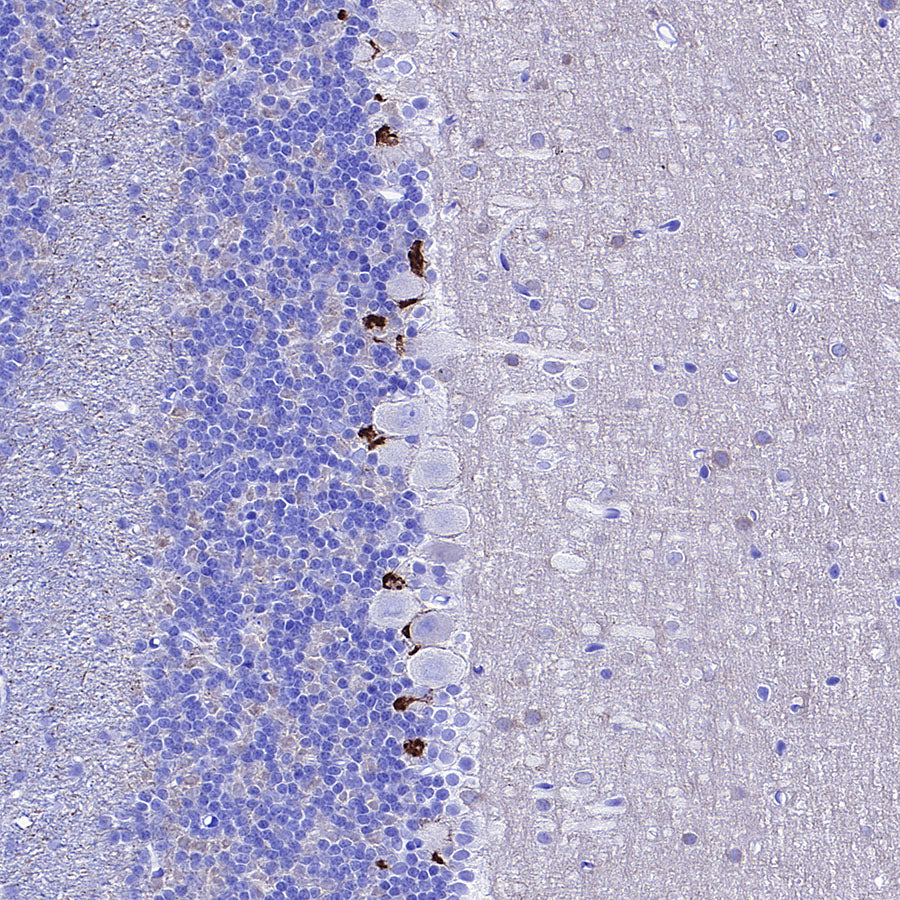 KCNA2 Recombinant Rabbit mAb (S-3939-53)