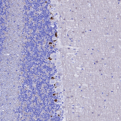 KCNA2 Recombinant Rabbit mAb (S-3939-53)