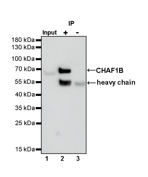 CHAF1b Recombinant Rabbit mAb (S-R316)