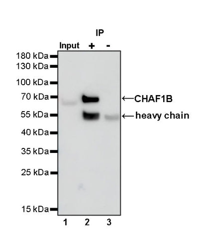 CHAF1b Recombinant Rabbit mAb (S-R316)