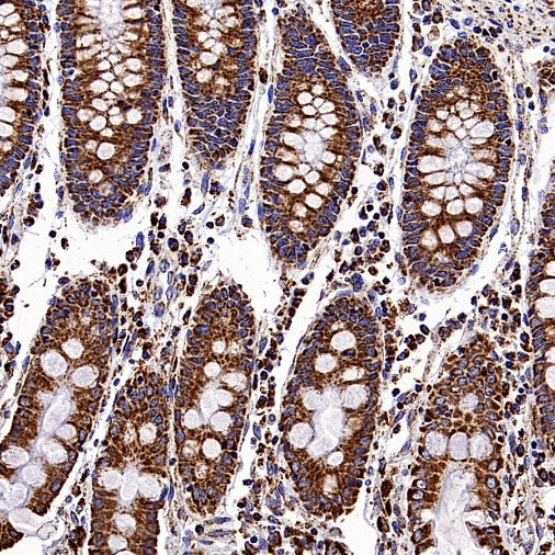 VDAC1 + VDAC2 + VDAC3 Rabbit Polyclonal Antibody