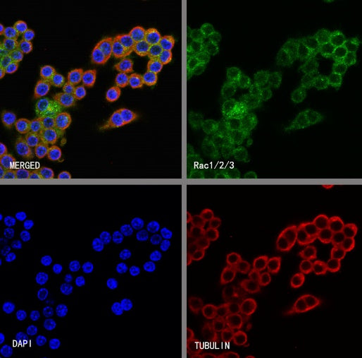 Rac1/2/3 Recombinant Rabbit mAb (S-2720-10)