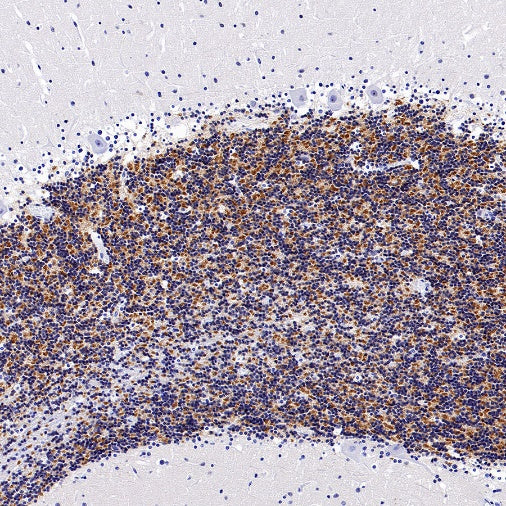 GABRD Recombinant Rabbit mAb (S-1584-162)