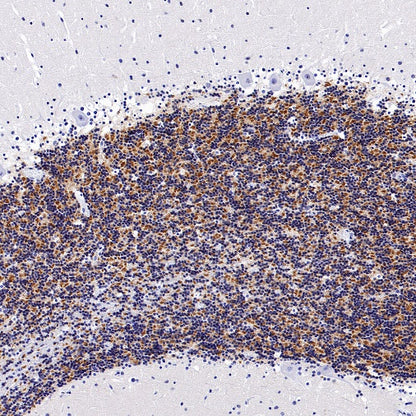 GABRD Recombinant Rabbit mAb (S-1584-162)