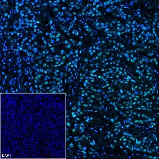 CREB Recombinant Rabbit mAb (S-1115-39)