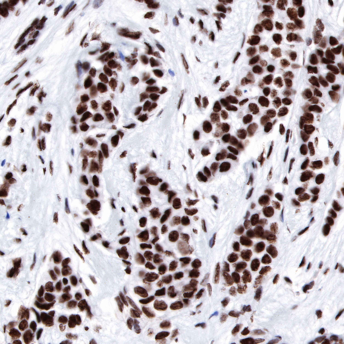 FUBP1 Recombinant Rabbit mAb (SDT-R060)