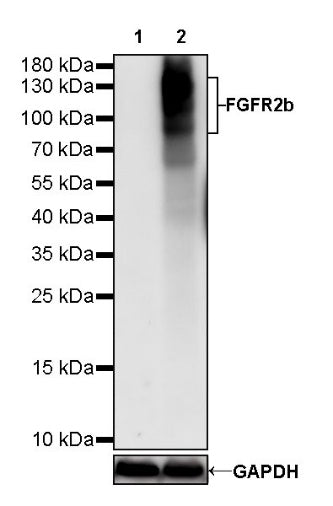 FGFR2b Recombinant Rabbit mAb (SDT-423-2)
