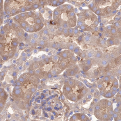 PI3 Kinase p85α Recombinant Rabbit mAb (S-328-24)