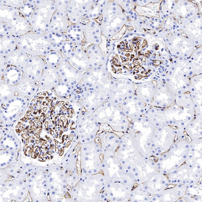 HLA-E Recombinant Rabbit mAb (S-1081-62)
