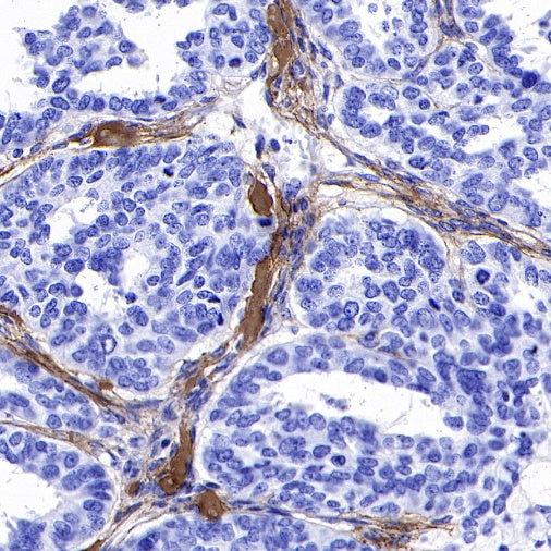 S-RMab® Collagen I (COL1A1) Recombinant Rabbit mAb (S-463-3)