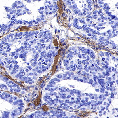 S-RMab® Collagen I (COL1A1) Recombinant Rabbit mAb (S-463-3)