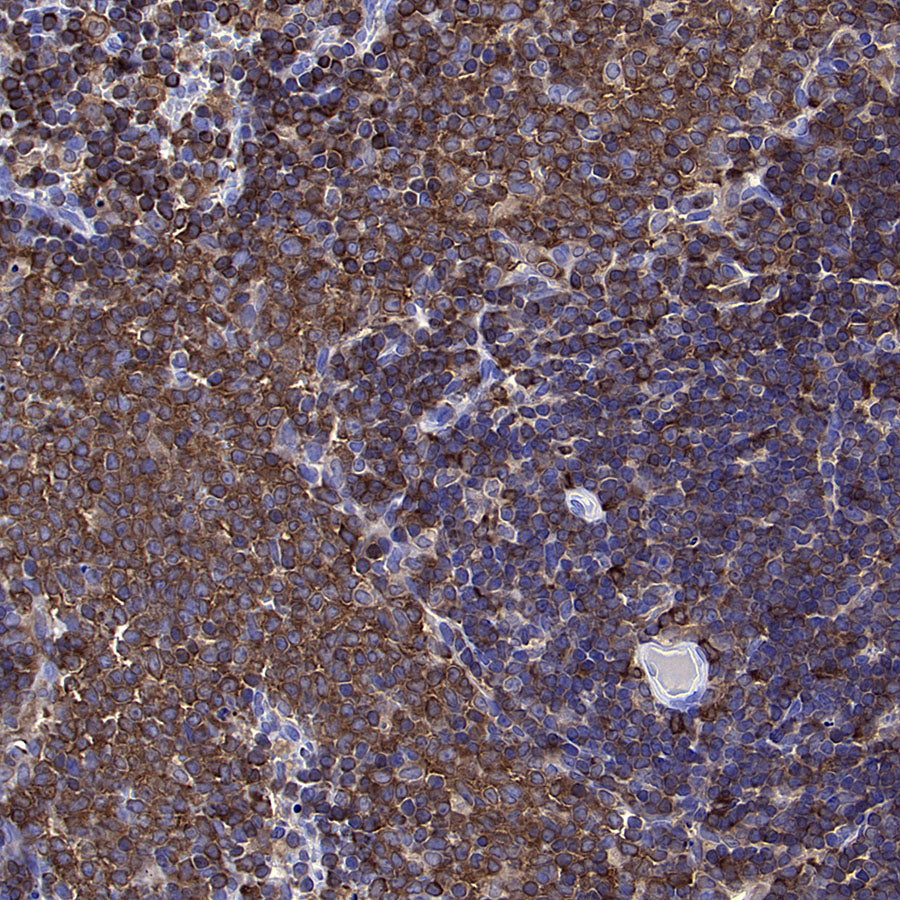 PTPN6 Rabbit Polyclonal Antibody
