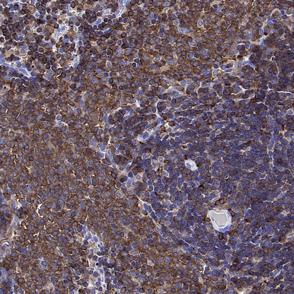 PTPN6 Rabbit Polyclonal Antibody