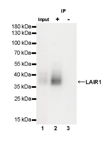 LAIR1 Recombinant Rabbit mAb (S-285-2)