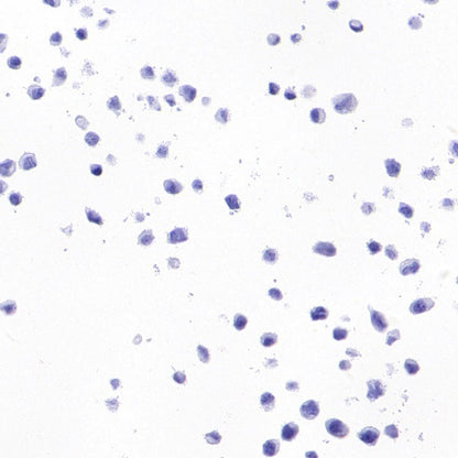 SEZ6 Recombinant Rabbit mAb (SDT-2097-7)
