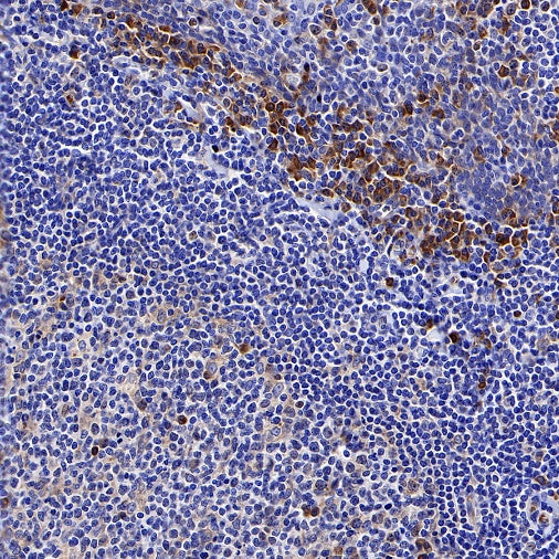 cGAS Recombinant Rabbit mAb (S-708-15)
