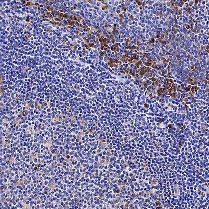 cGAS Recombinant Rabbit mAb (S-708-15)
